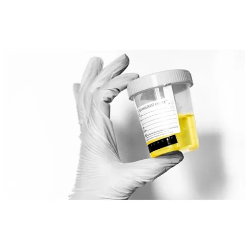 [DreamCATchers] Donatie voor de poezen: Urine onderzoek